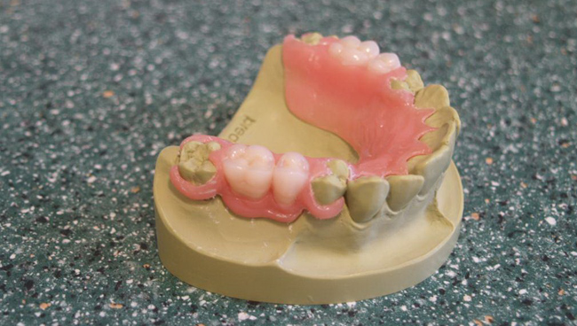 Dentures | Dentist Montenegro