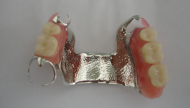Dentures | Dentist Montenegro
